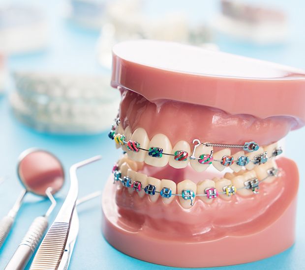Dental Implants