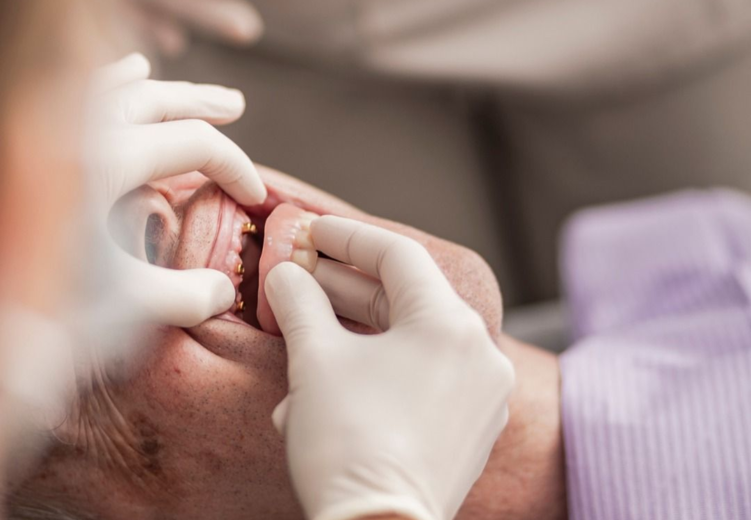 full mouth rehabilation dental care