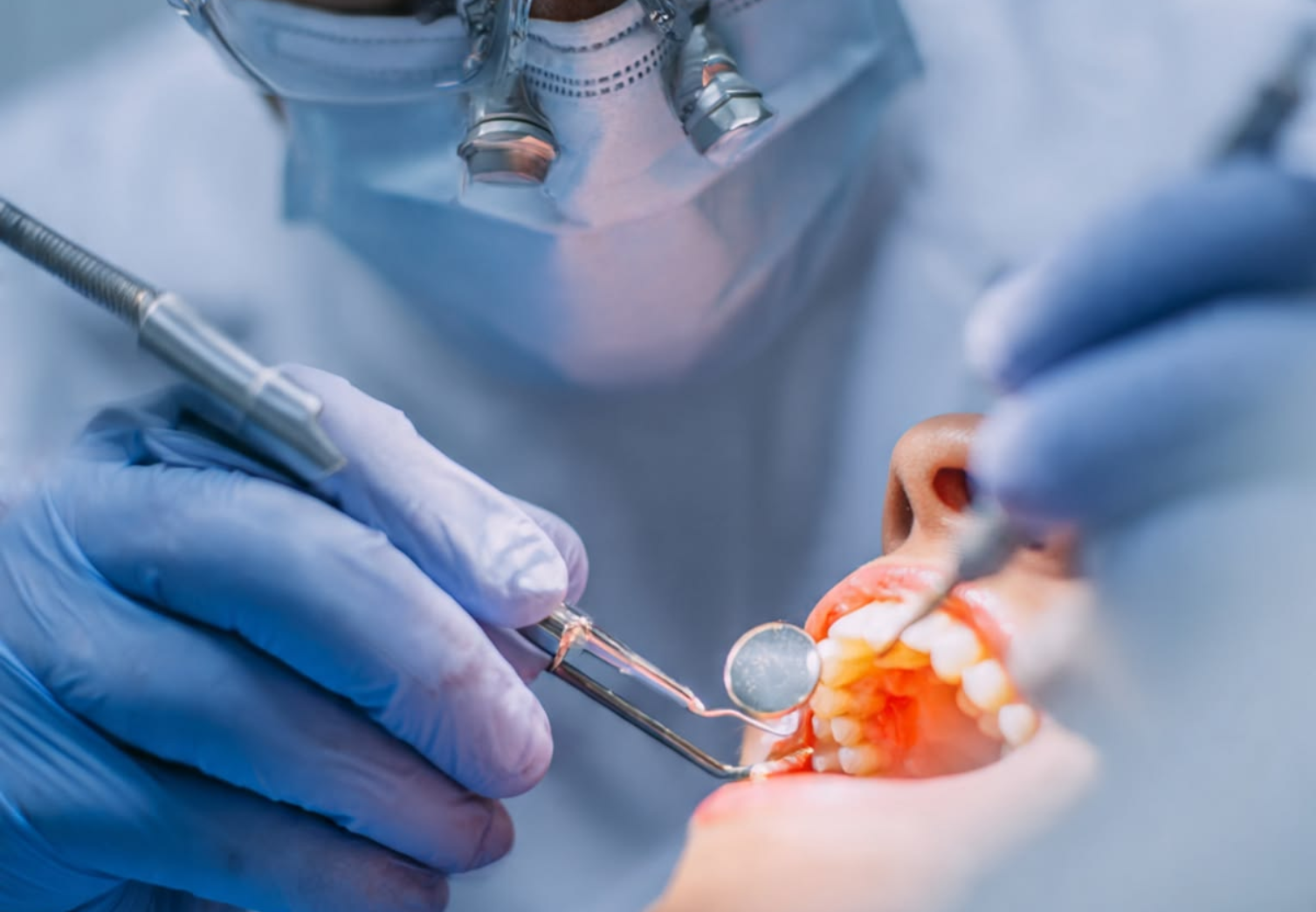 full mouth rehabilation Dental Care