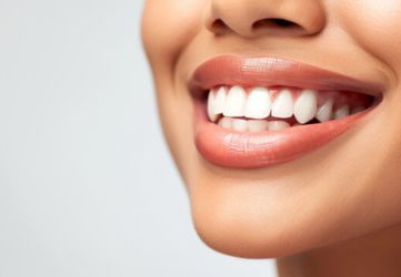 Cosmetic Smile Makeover